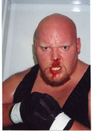 bloodynose